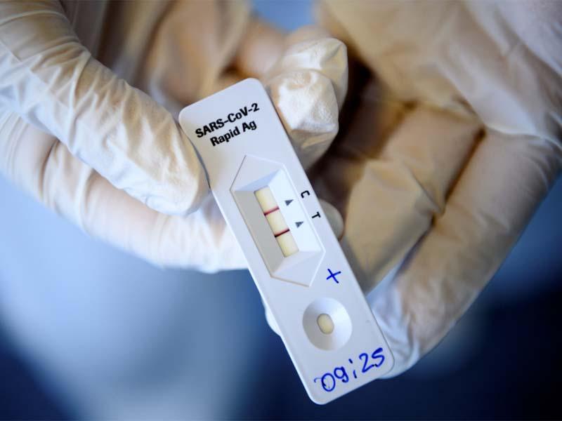 covid 19 feu vert exceptionnel pour l autotest rapide de roche en suisse allnews